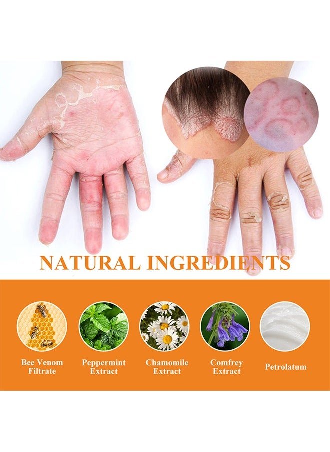 South Moon - Bee Venom Psoriasis Care Cream